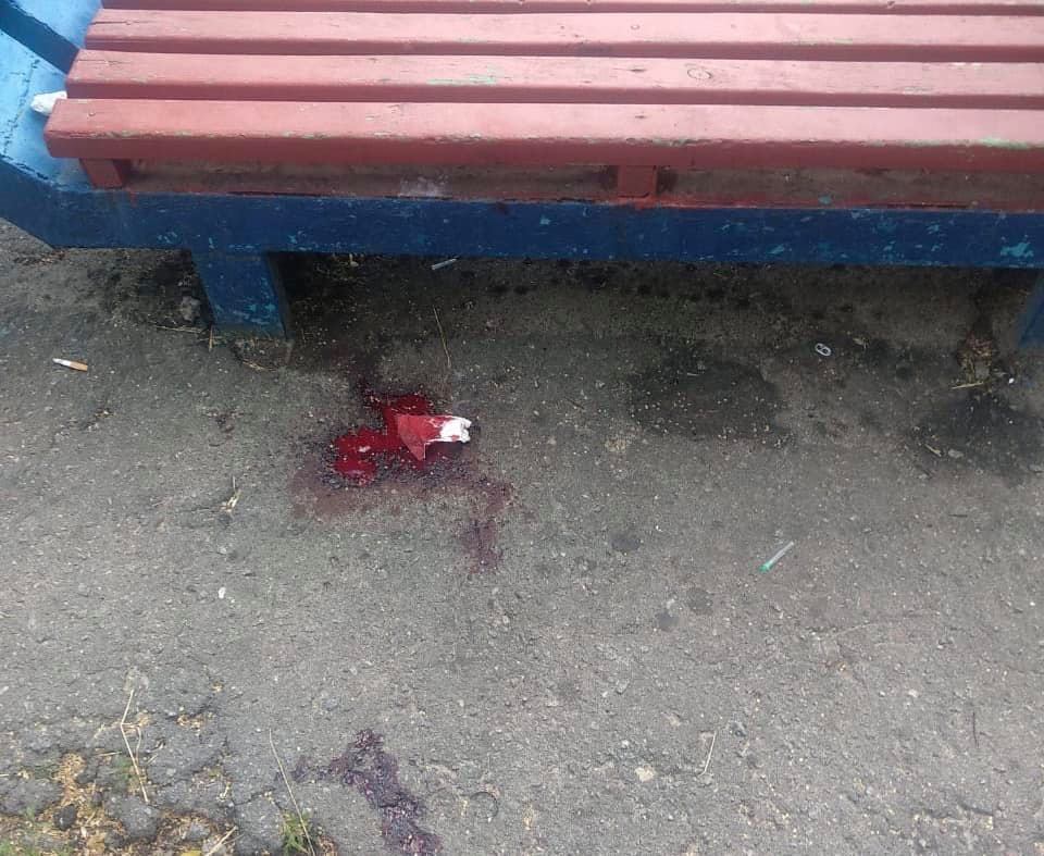 порізав ножем перехожих